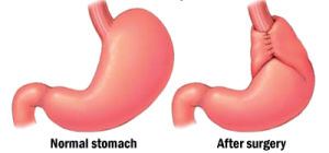 Stomach